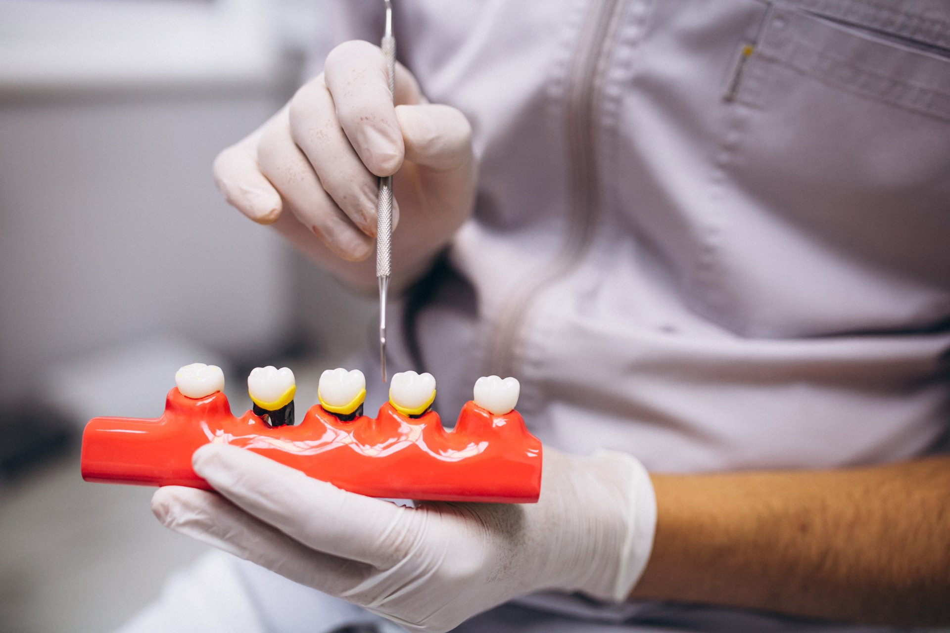 Clinica Dental Dominguez Lemus - Periodoncia