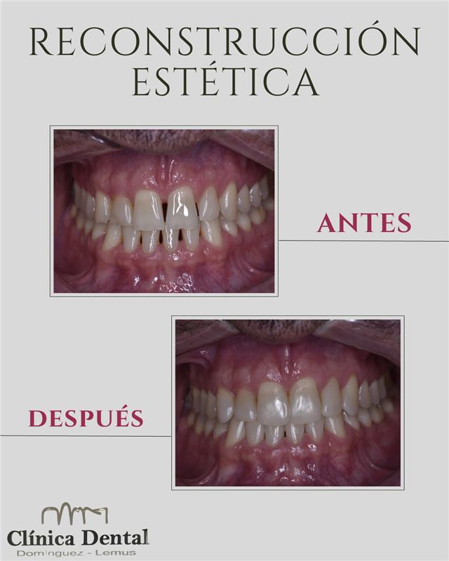 Clínica Dental Domínguez Lemus